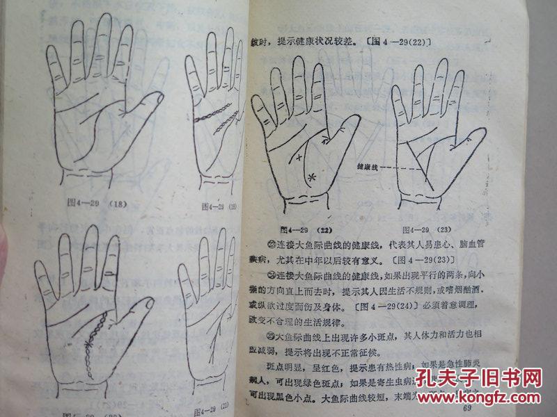手纹与健康