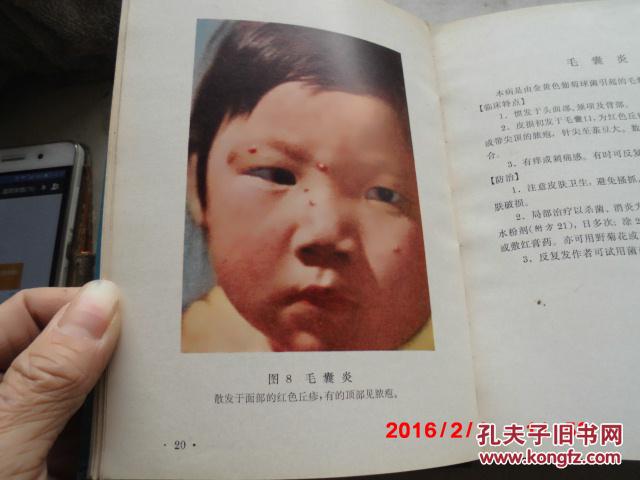【图】常见皮肤病图谱(精装)_价格:16.00