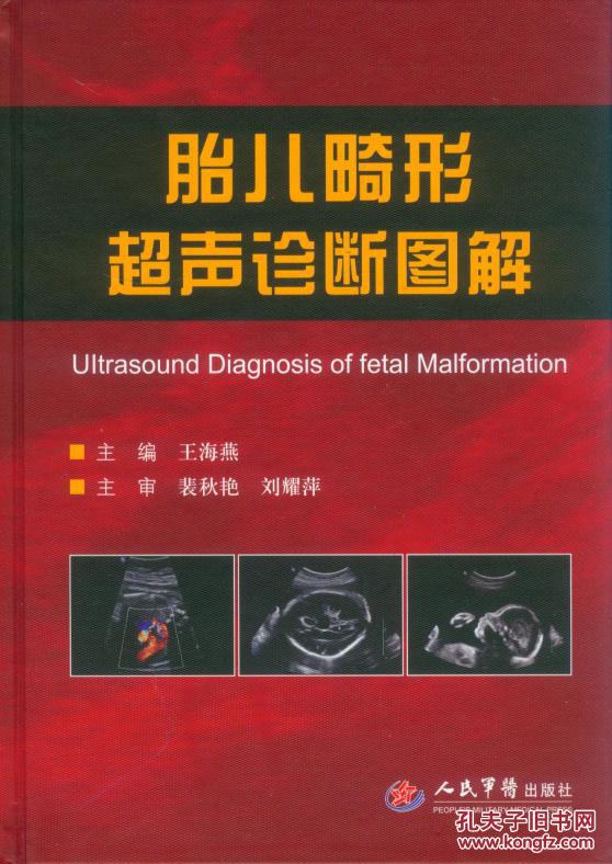 【图】胎儿畸形超声诊断图解_价格:150.00