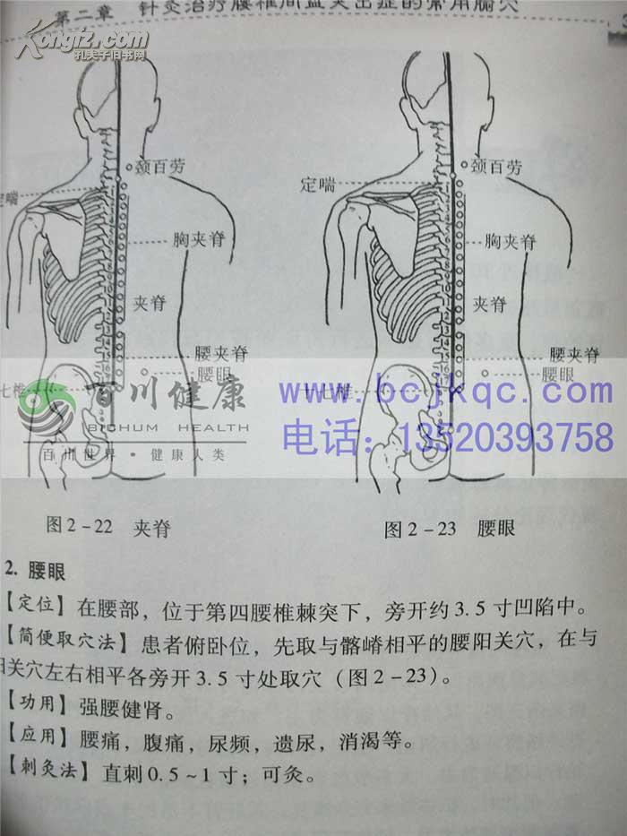 针灸穴位治疗常见病一本通 腰椎间盘突出症