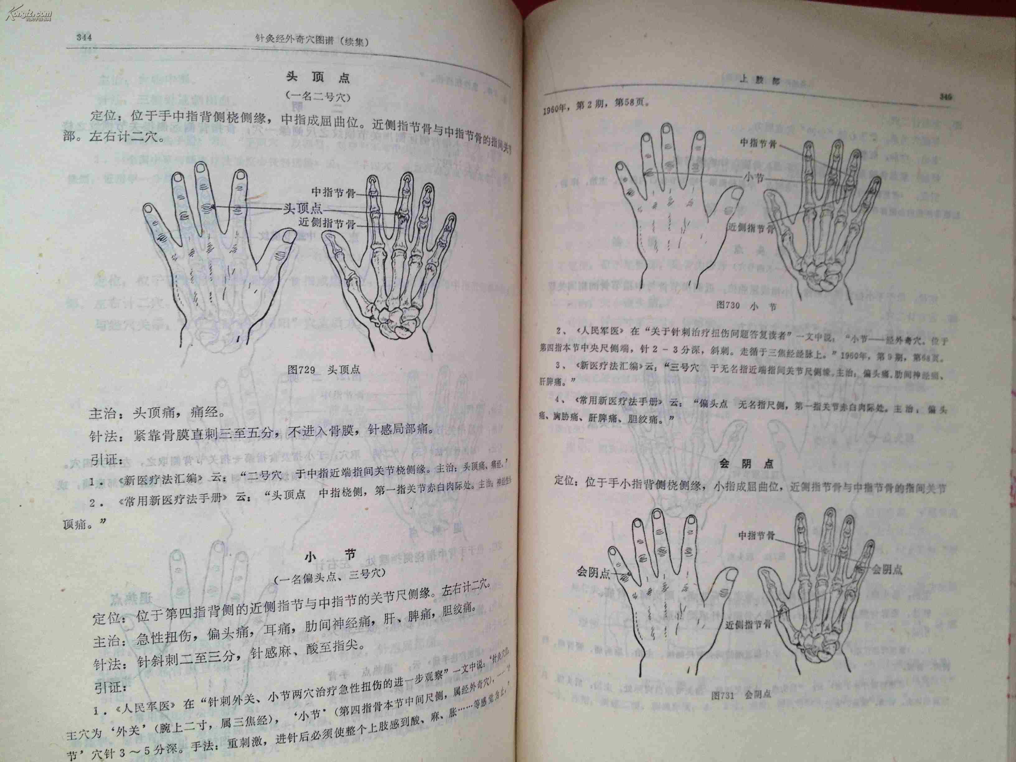 针灸经外奇穴图谱:续集 一版一印 校藏本