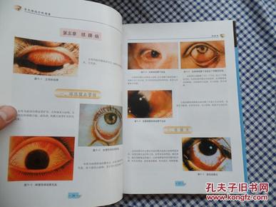 常见眼病诊断图谱-精装--heguo