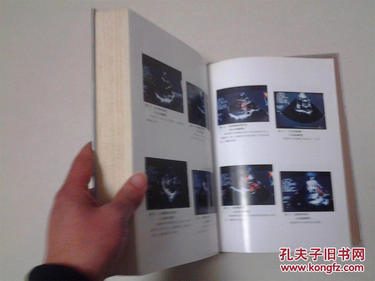 【图】临床超声鉴别诊断学_价格:50.00