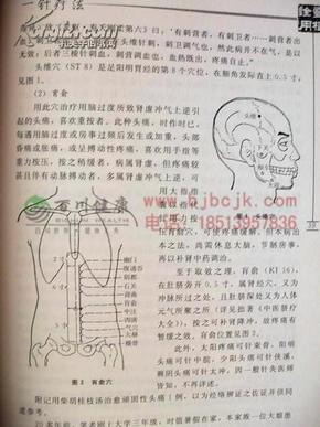 一针疗法
