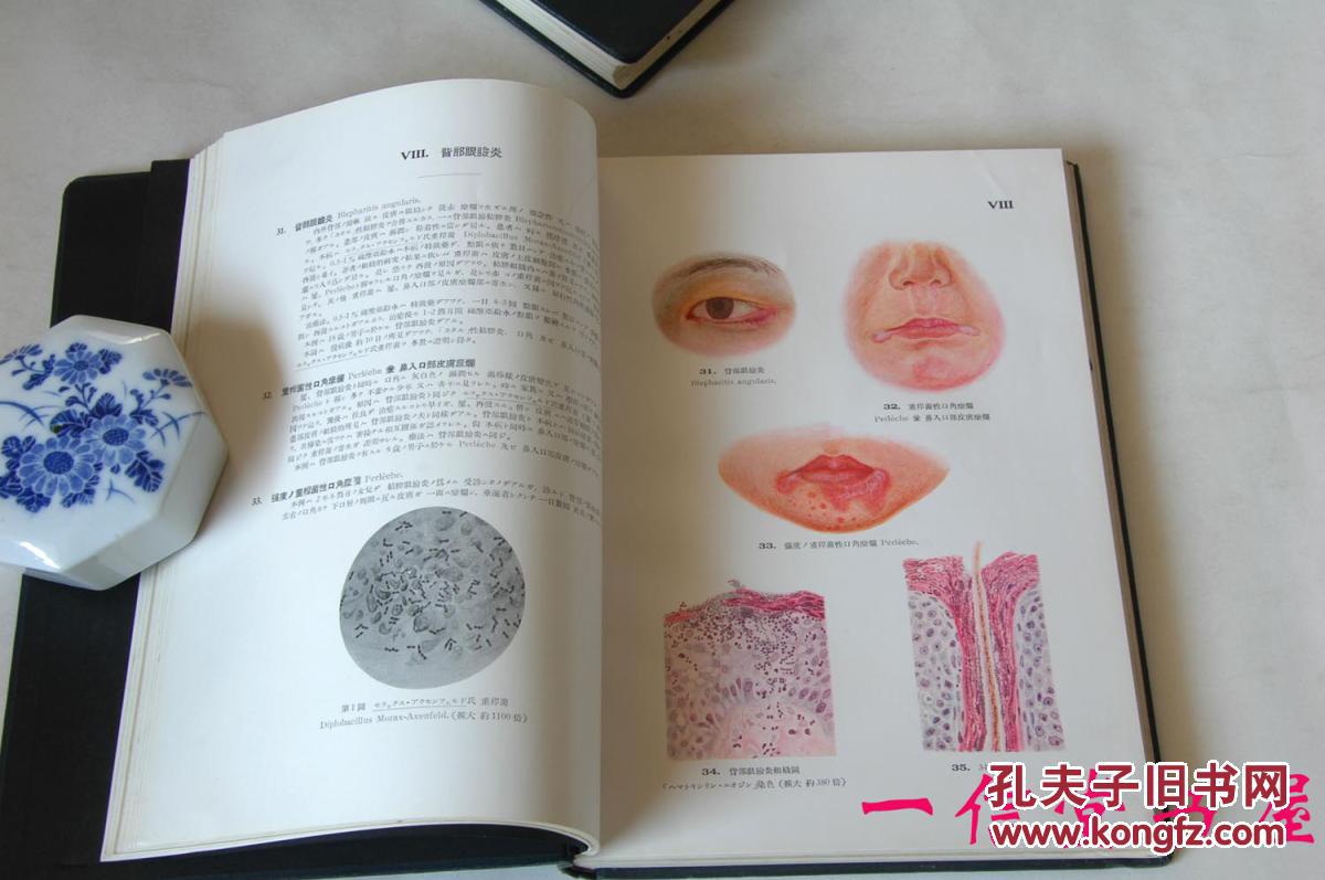 《眼科图谱》2册全 日文 东京帝国大学教授医