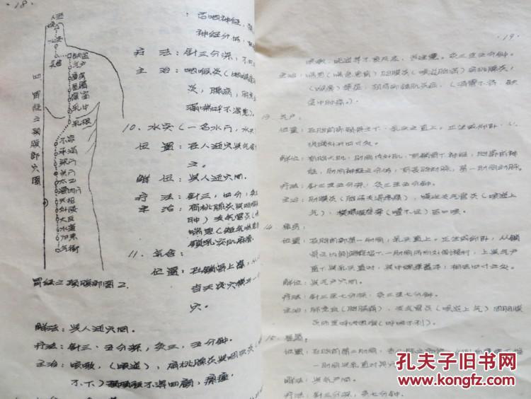 早期油印本 北京石广济针灸传习班讲义 罕见本 带图(全店满30元包挂刷