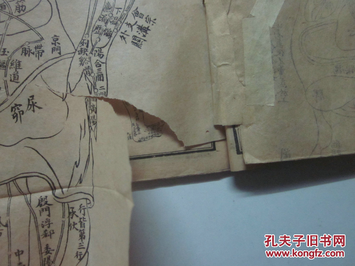 【图】民国石印线装版 增补绘图针灸大全(存卷