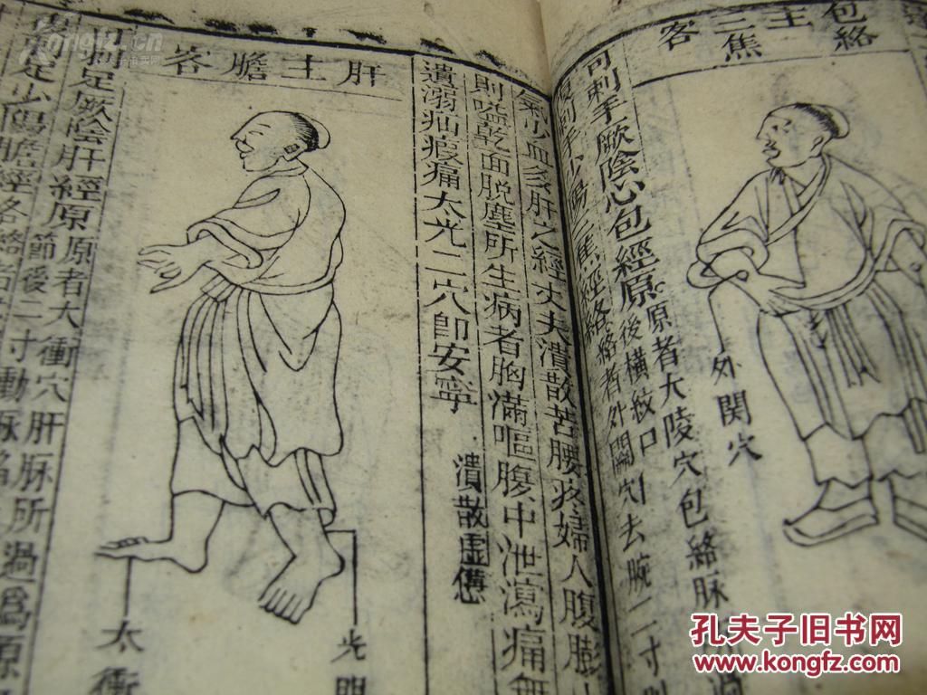 【图】出一本天头满批很多的针灸大成或者针灸