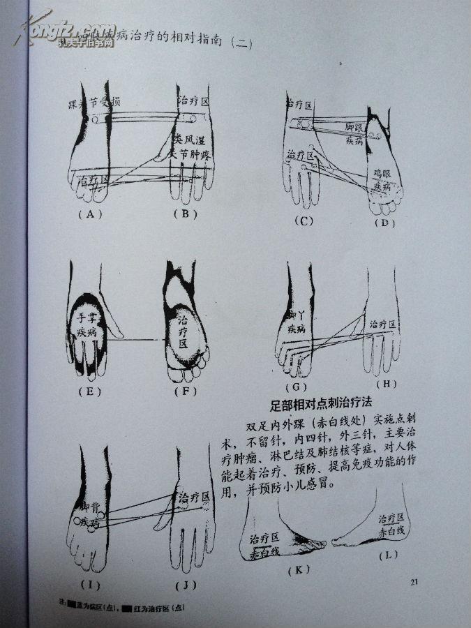 中国的新针灸 八字治疗法】原百病神针教材书/内部教材 复印