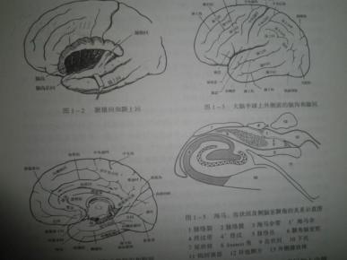 颞叶癫痫外科图片