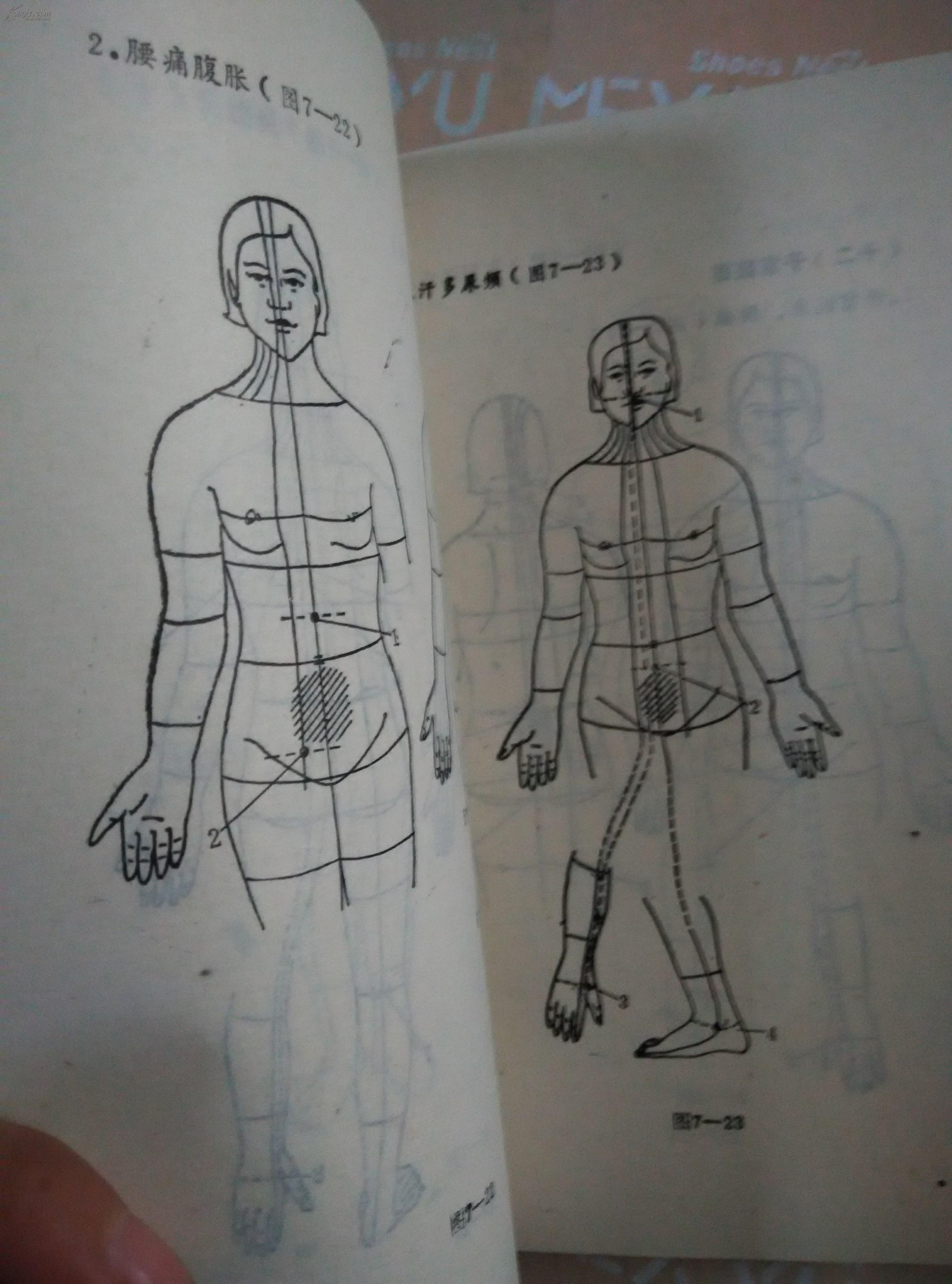 针灸有效点图解