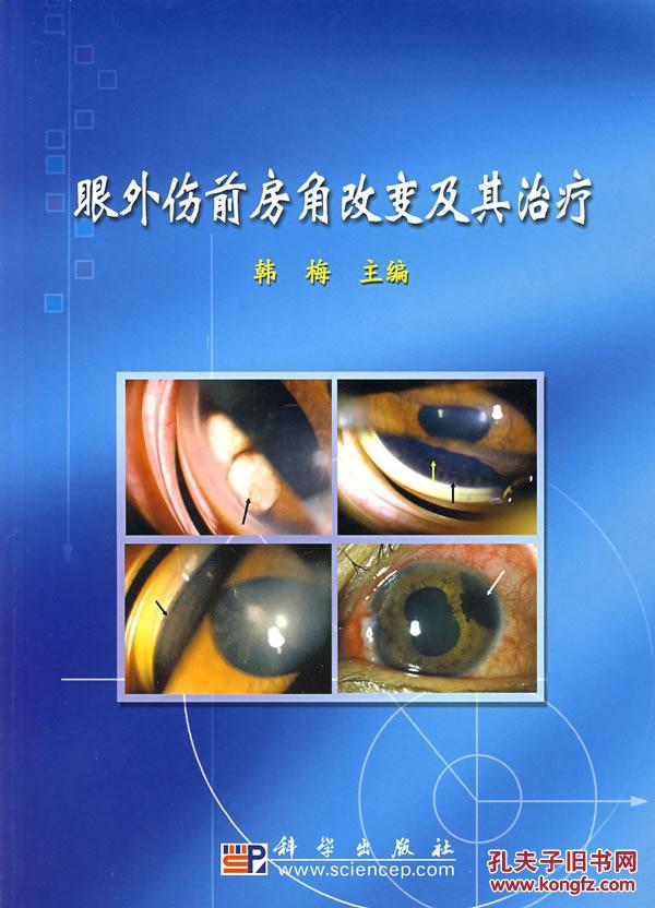 眼外伤前房角改变及其