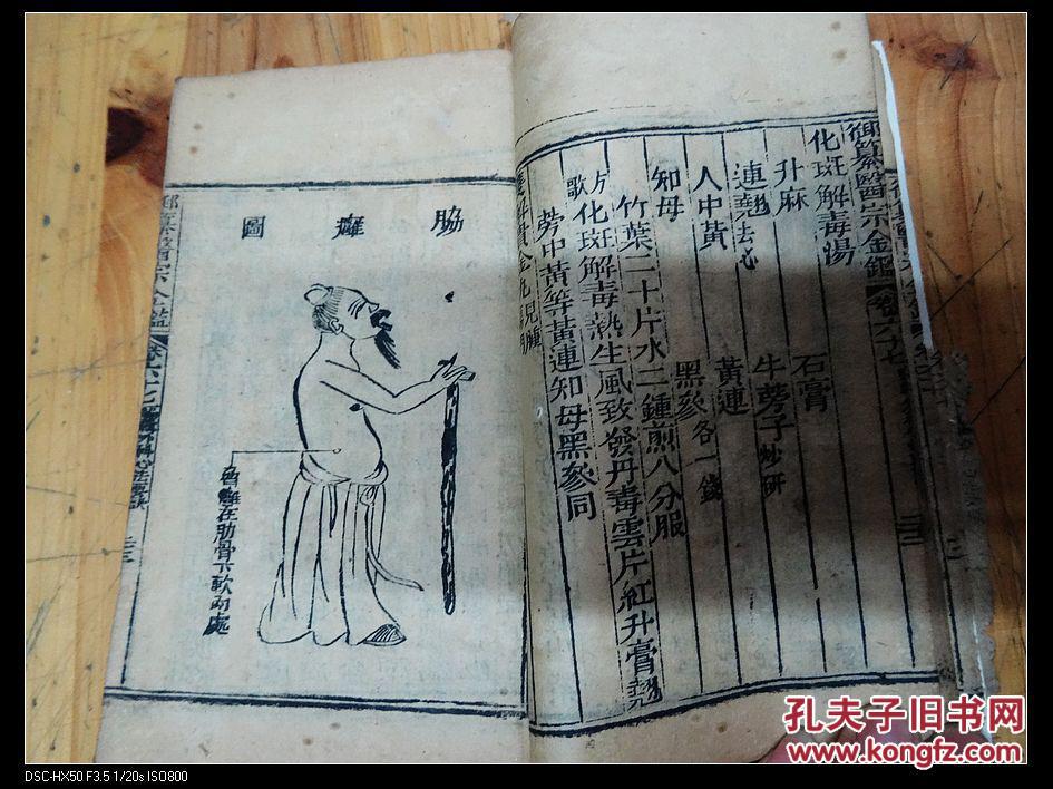 2867:木刻本《御纂医宗金鉴》(卷67卷68,编辑外科心法要诀)内有调疽图