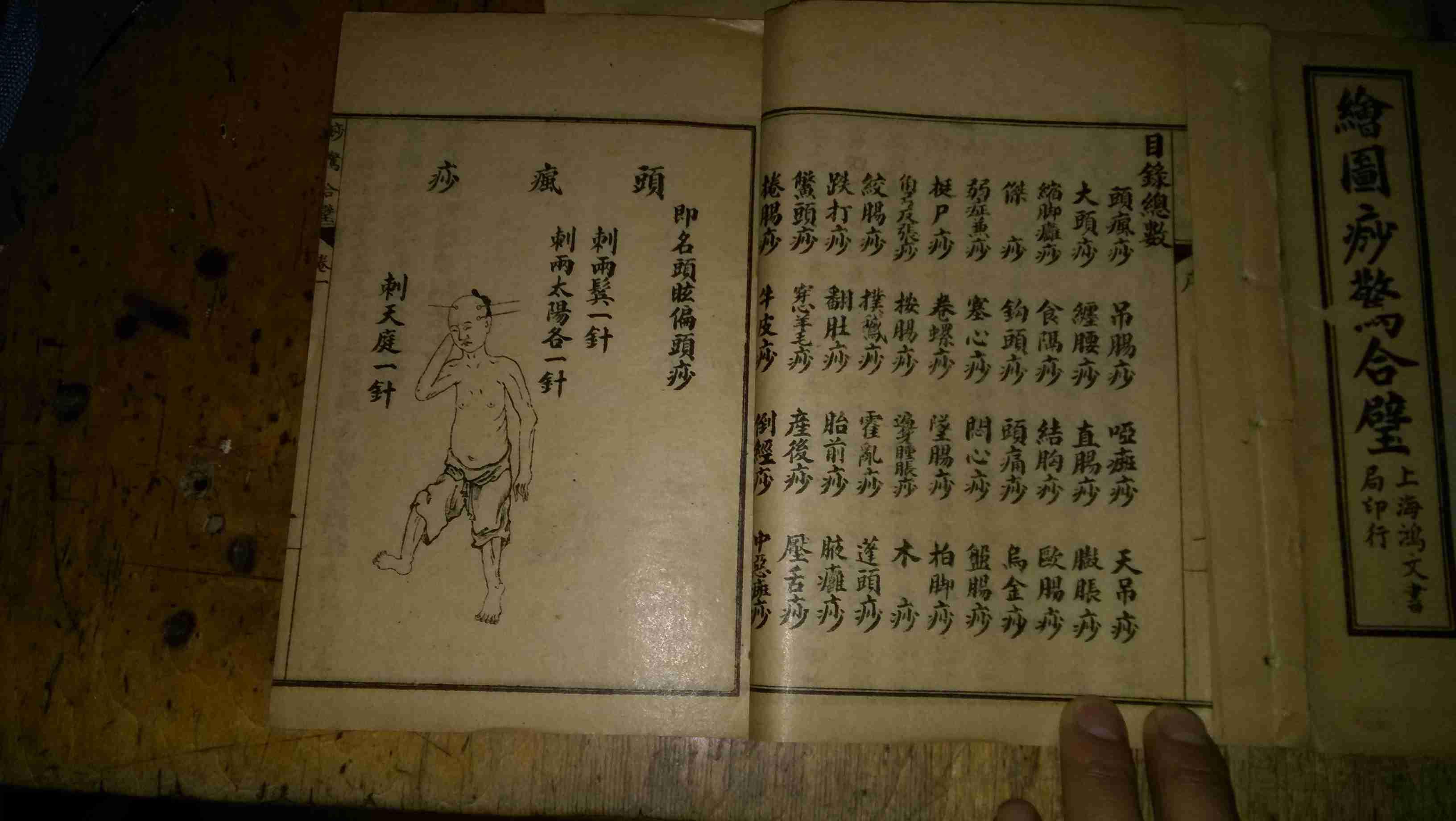 绘图痧惊合璧 卷一至卷三(1-3册全图)民国6年上海鸿文书局印行