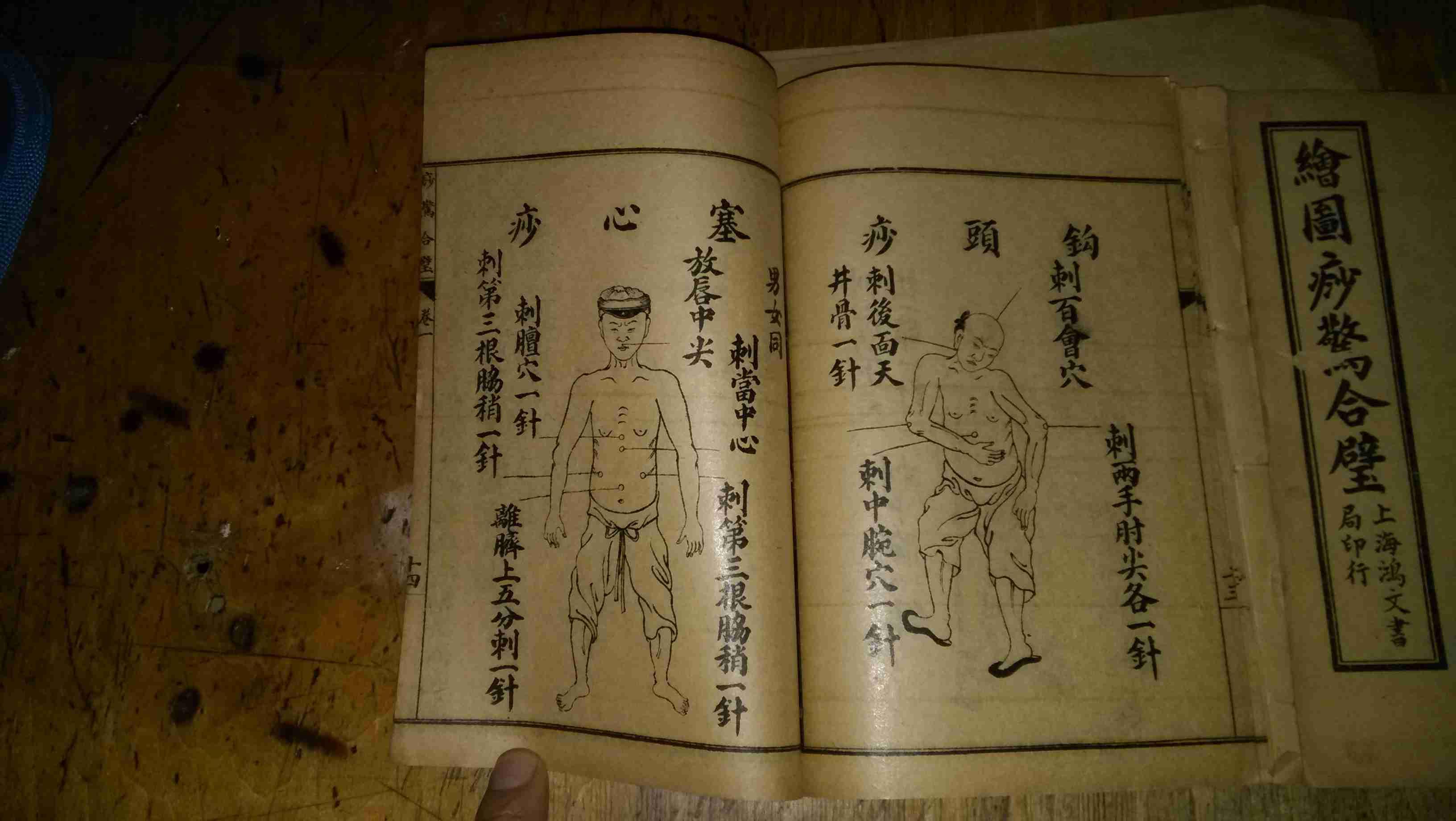 绘图痧惊合璧 卷一至卷三(1-3册全图)民国6年上海鸿文书局印行