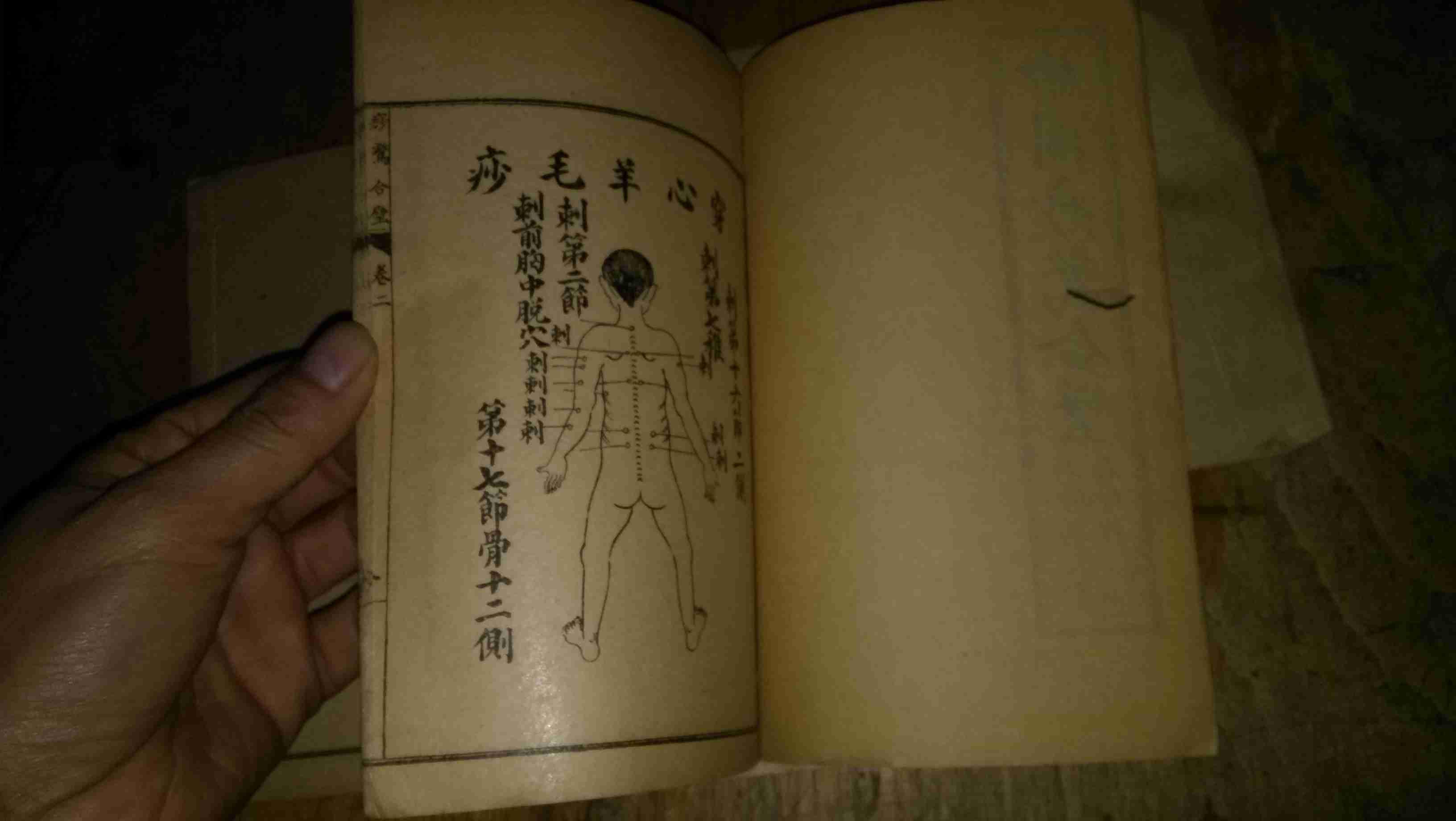 绘图痧惊合璧 卷一至卷三(1-3册全图)民国6年上海鸿文书局印行