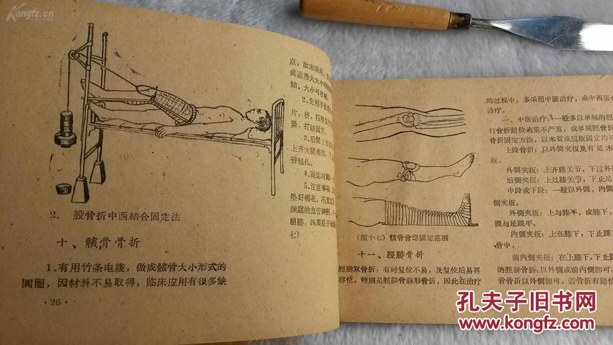 中医正骨手法图解
