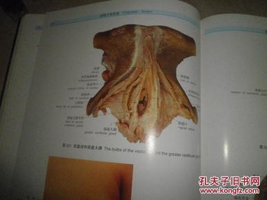 人体解剖学标本彩色图谱(大16开,彩印精装,本书荣获中国图书奖)