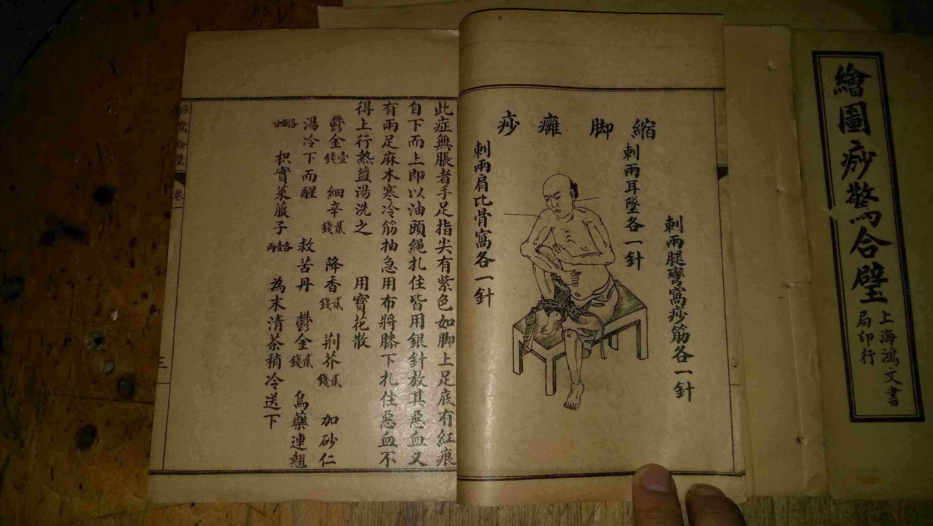 绘图痧惊合璧 卷一至卷三(1-3册全图)民国6年上海鸿文书局印行