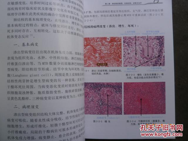 肺结核电子支气管镜及影像解剖彩色图谱