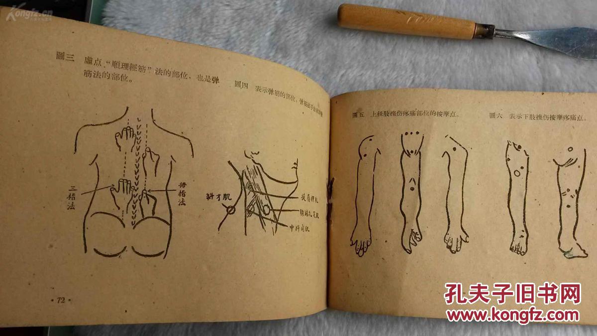 中医正骨手法图解