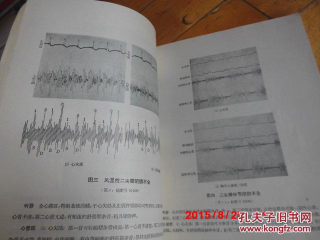 心脏听诊与心音图