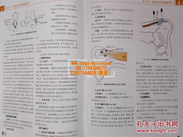2015年庞继光教授最新版全彩图解版针刀医学基础与临床深圳·海天出版
