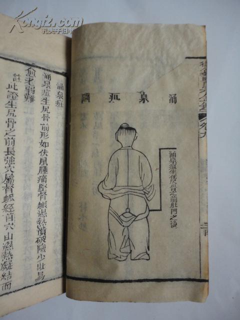 御纂医宗金鉴卷九卷十编辑外科心法要诀下部穿档发阴疽等多图解说木刻