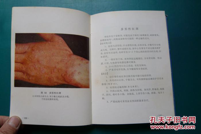 常见皮肤病图谱