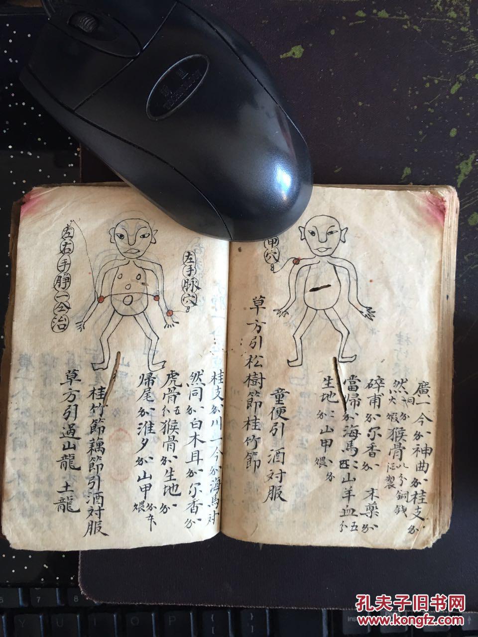 架梁穴吃药,又咳嗽失声用药方,凤尾穴水药方,寻痛散,两手接骨药,损