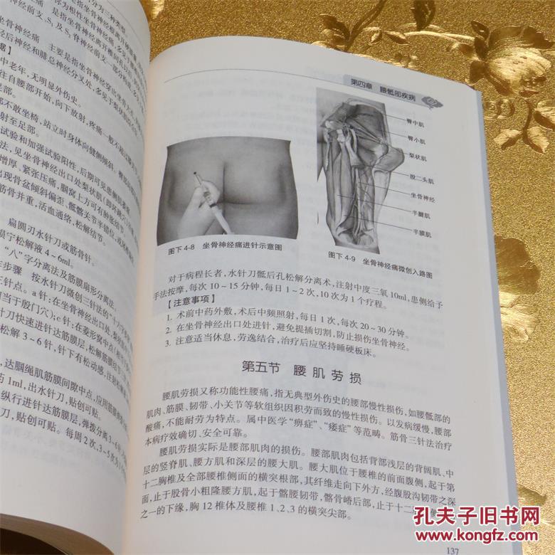 中医外治疗法图 poYBAFd2PgGAAfk3AAGL9XDBKZM514_b.jpg