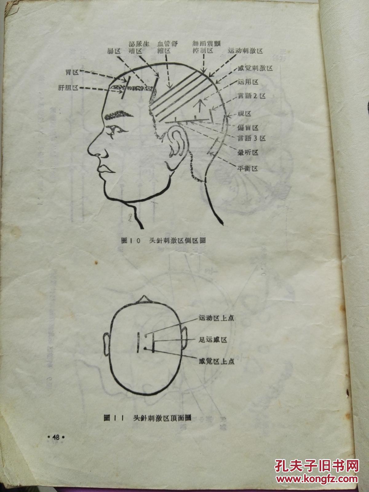 头针疗法资料汇辑 【72年内发中医类】