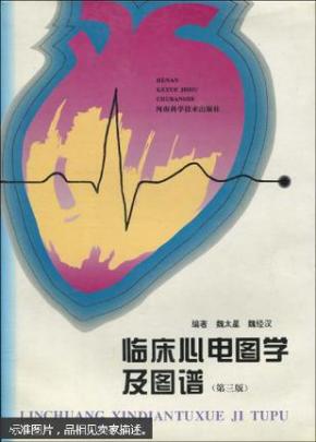 poYBAFdFi_aAP358AABWxRXL8m8042_n.jpg