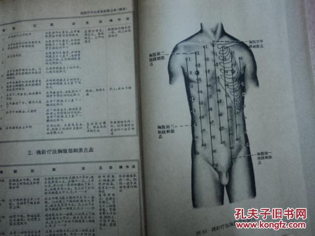 针灸简谱_中医针灸图片