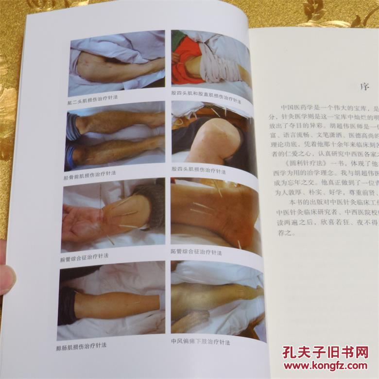 最新版圆利针疗法:运动性损伤中西医结合针灸疗法
