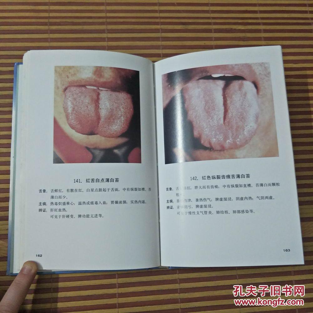 中医舌苔图谱