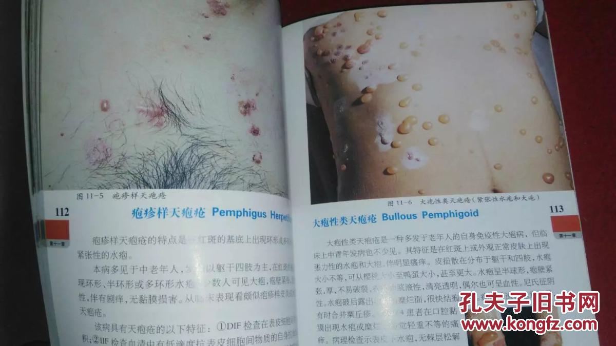 临床实用皮肤病性病图谱(天津科技)2008年一版一印(彩色图谱)