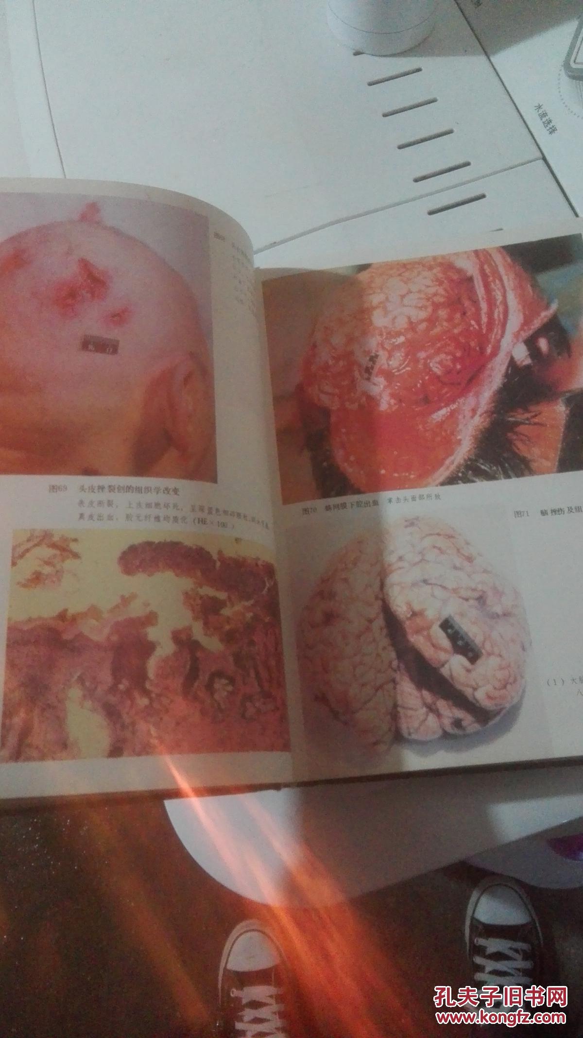 法医学彩色图谱