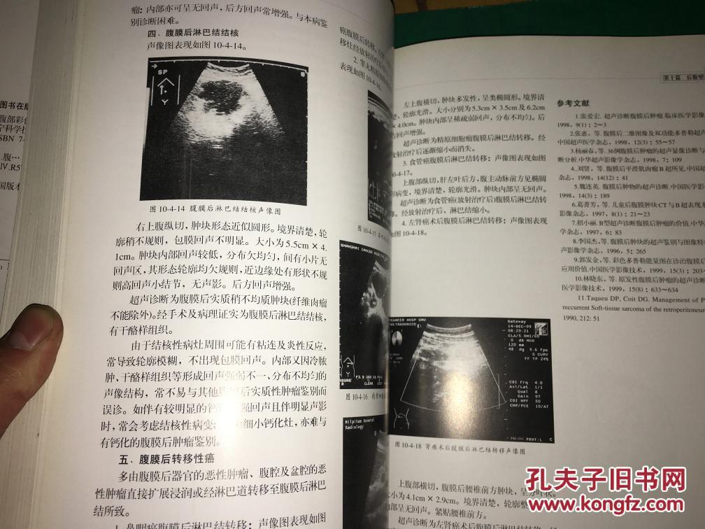 腹部彩色超声诊断图谱