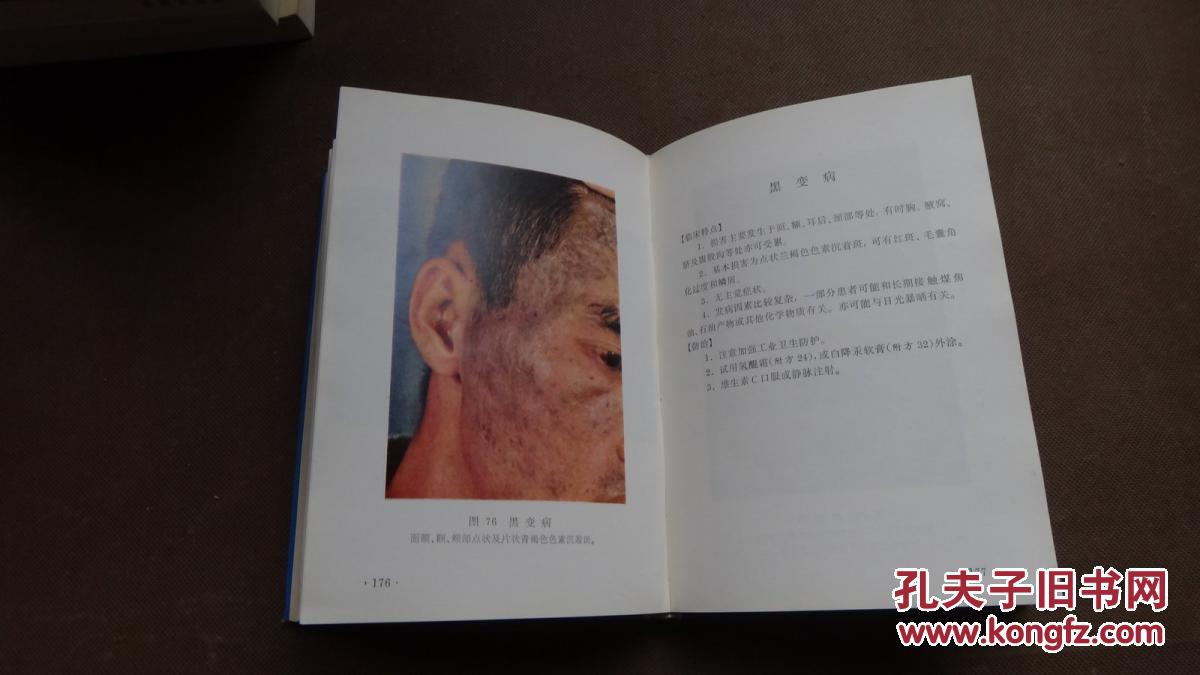 常见皮肤病图谱