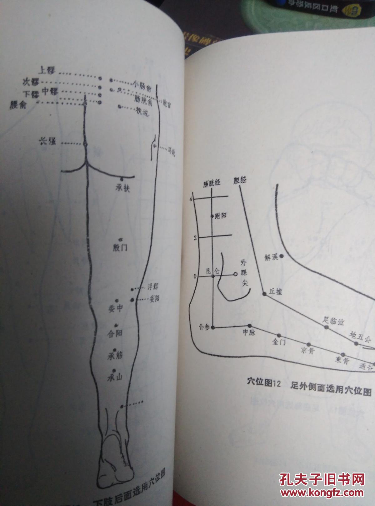 《推拿疗法歌诀一百例》1册 内附手法穴位图 1988年1版1印