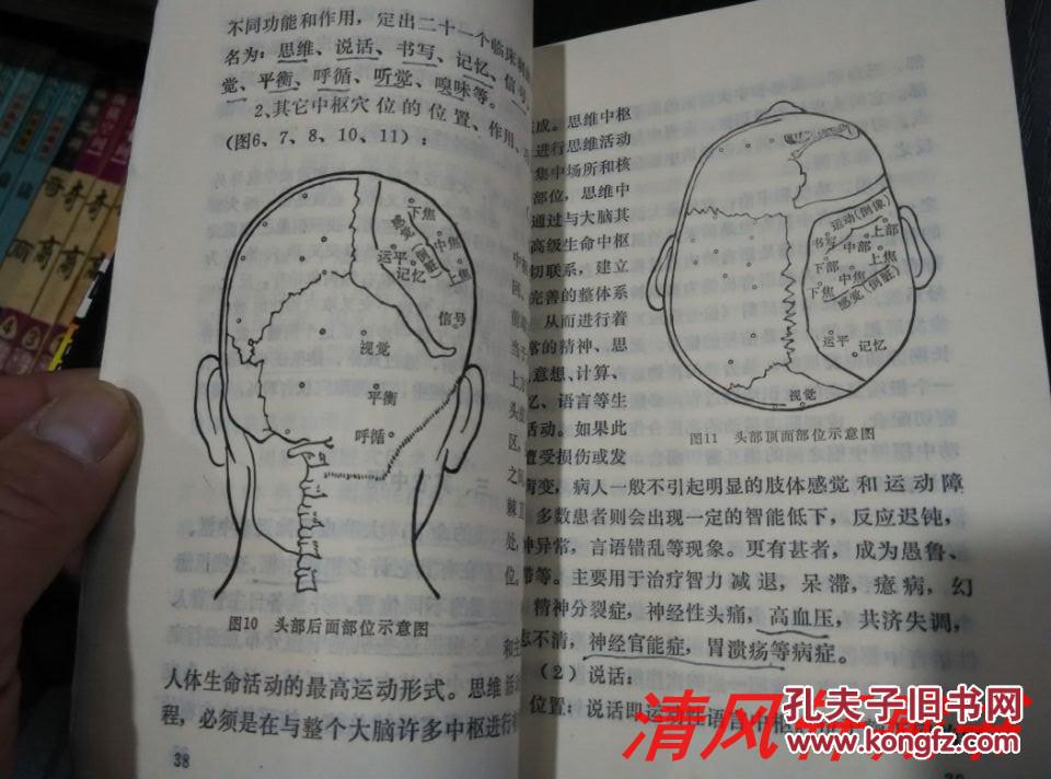 一把刀"82年1版1986年9月2印方氏头皮针理论获得国家科技进步三等奖