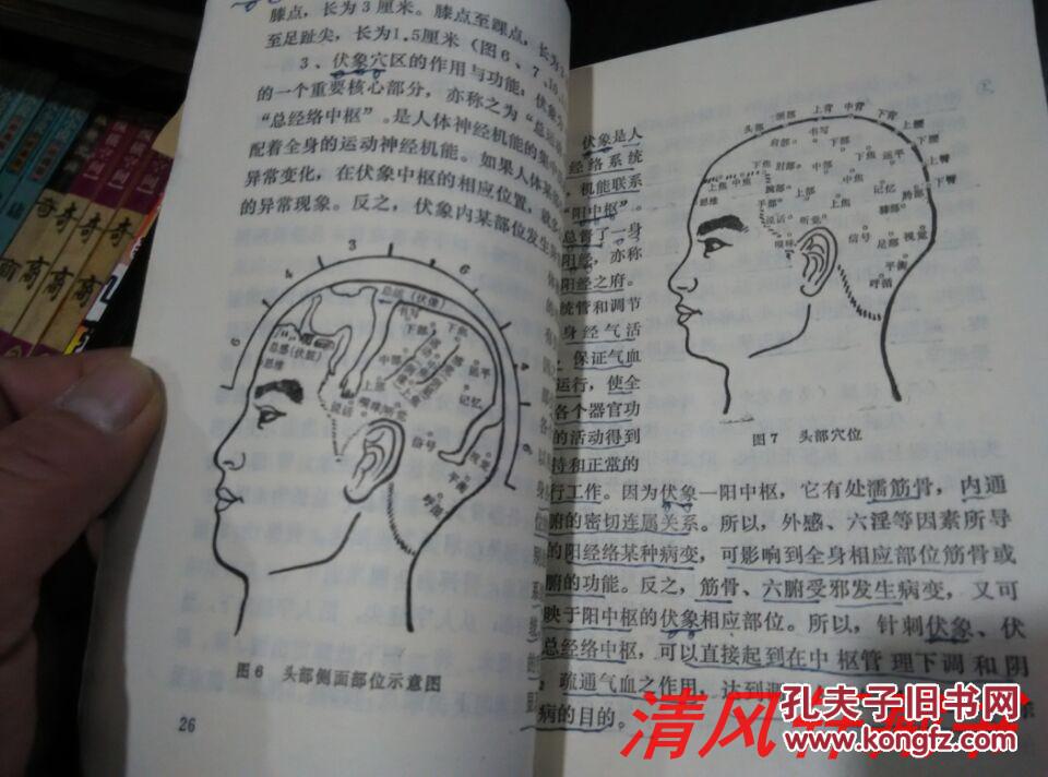 一把刀"82年1版1986年9月2印方氏头皮针理论获得国家科技进步三等奖