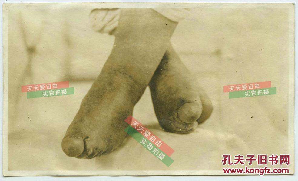 民国赤裸的三寸金莲小脚缠足足部特写老照片