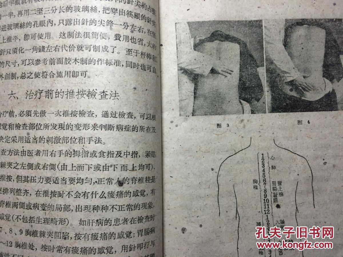 七星针疗法