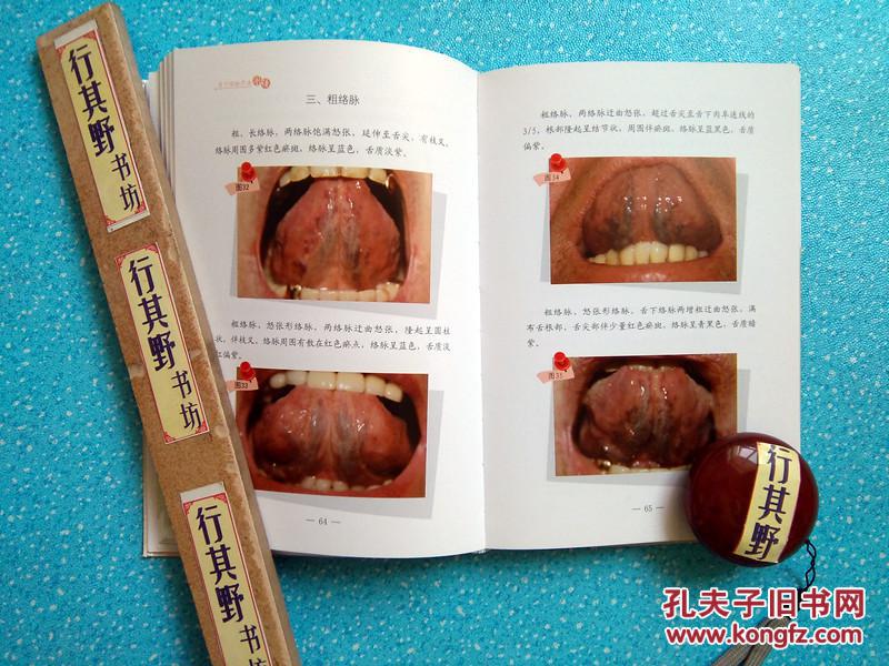 【图】【包邮挂】【舌下络脉诊法图谱】从历史