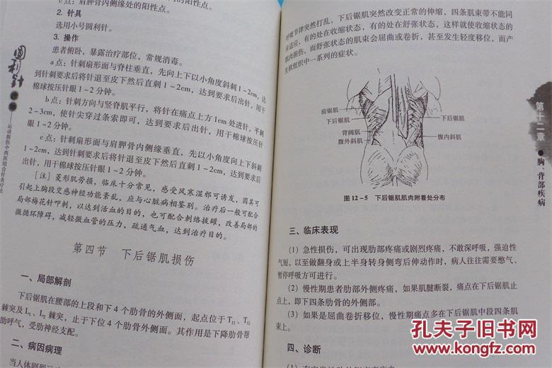 圆利针疗法:运动性损伤中西医结合针灸疗法最新版 胡超伟 著 长江出版