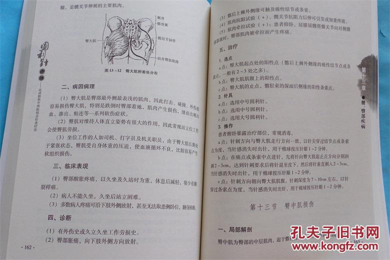 圆利针疗法:运动性损伤中西医结合针灸疗法最新版 胡超伟 著 长江出版