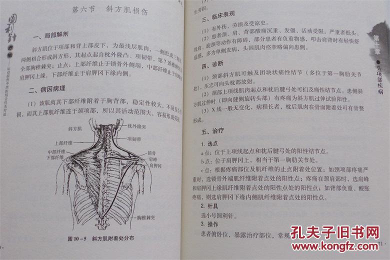 圆利针疗法:运动性损伤中西医结合针灸疗法最新版 胡超伟 著 长江出版
