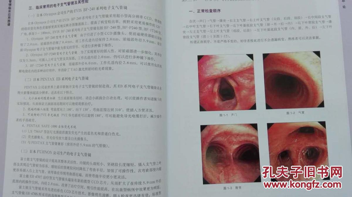 电子支气管镜临床应用图谱 一版一刷 人民军医出版社
